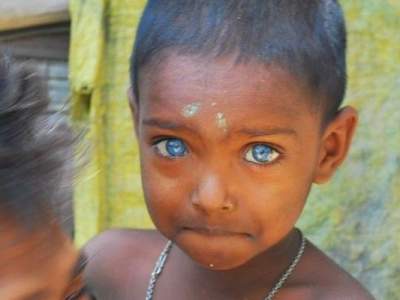 Удивительные африканские дети с голубыми глазами. Фото