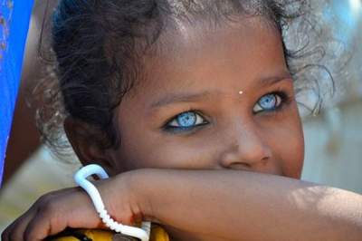 Удивительные африканские дети с голубыми глазами. Фото