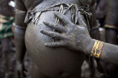 Жители эфиопского племени, страдающие от ожирения. Фото