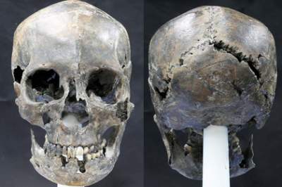 В Корее нашли древнее погребение женщины с необычно вытянутым черепом
