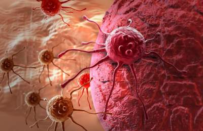 Медики выяснили, как именно раковые клетки убивают организм