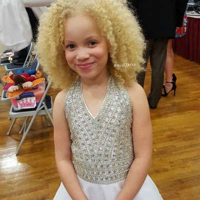 Афроамериканка-альбинос стала популярной моделью
