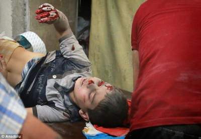 Журналисты показали детей, пострадавших от войны в Сирии. Фото